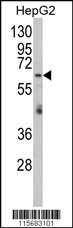 Western blot analysis of RARS2 Antibody (C-term) (Cat. #AP8590b) in HepG2 cell line lysates (35ug/lane). RARS2 (arrow) was detected using the purified Pab.