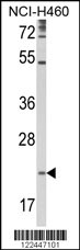 Western blot analysis of TSPAN31 Antibody (Center) (Cat. #AP8587c) in NCI-H460 cell line lysates (35ug/lane).TSPAN31 (arrow) was detected using the purified Pab.(2ug/ml)