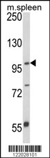 Western blot analysis of ANO5 Antibody (C-term) (Cat. #AP8580b) in mouse spleen tissue lysates (35ug/lane). ANO5 (arrow) was detected using the purified Pab.