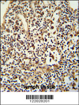 ANO5 Antibody (C-term) (Cat. #AP8580b) immunohistochemistry analysis in formalin fixed and paraffin embedded human lymph tissue followed by peroxidase conjugation of the secondary antibody and DAB staining. This data demonstrates the use of theANO5 Antibody (C-term) for immunohistochemistry. Clinical relevance has not been evaluated.