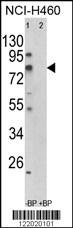 Western blot analysis of ACSS3 Antibody (Center) (Cat. #AP8579c) in NCI-H460 cell line lysates (35ug/lane). ACSS3 (arrow) was detected using the purified Pab.(2ug/ml)