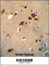 PKHG1 Antibody (C-term) (Cat. #AP10798b) immunohistochemistry analysis in formalin fixed and paraffin embedded human brain tissue followed by peroxidase conjugation of the secondary antibody and DAB staining. This data demonstrates the use of the PKHG1 Antibody (C-term) for immunohistochemistry. Clinical relevance has not been evaluated.