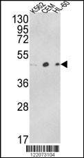 Western blot analysis of ACTR3B Antibody (C-term) (Cat. #AP8540b) in K562, CEM, HL-60 cell line lysates (35ug/lane). ACTR3B (arrow) was detected using the purified Pab.