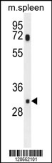 MCAR1 Antibody (N-term) (Cat. #AP10796a) western blot analysis in mouse spleen tissue lysates (35ug/lane).This demonstrates the MCAR1 antibody detected the MCAR1 protein (arrow).