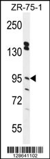 ERMP1 Antibody (C-term) (Cat. #AP10790b) western blot analysis in ZR-75-1 cell line lysates (35ug/lane).This demonstrates the ERMP1 antibody detected the ERMP1 protein (arrow).