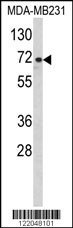 Western blot analysis of ARHGAP18 Antibody (Center) (Cat. #AP8516c) in MDA-MB231 cell line lysates (35ug/lane). ARHGAP18 (arrow) was detected using the purified Pab.