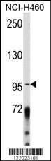 Western blot analysis of AKAP3 Antibody (Center) (Cat. #AP8515c) in NCI-H460 cell line lysates (35ug/lane). AKAP3 (arrow) was detected using the purified Pab.