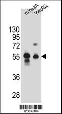 DPEP3 Antibody (C-term) (Cat. #AP10789b) western blot analysis in mouse heart tissue and HepG2 cell line lysates (35ug/lane).This demonstrates the DPEP3 antibody detected the DPEP3 protein (arrow).