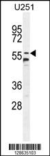 CCDC9 Antibody (N-term) (Cat. #AP10786a) western blot analysis in U251 cell line lysates (35ug/lane).This demonstrates the CCDC9 antibody detected the CCDC9 protein (arrow).