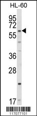 Western blot analysis of CYP51A1 Antibody (C-term) (Cat. #AP8874b) in HL-60 cell line lysates (35ug/lane). CYP51A1 (arrow) was detected using the purified Pab.
