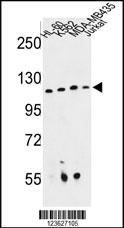 Western blot analysis of RPGRIP1 Antibody (Center) (Cat. #AP8871c) in HL-60, K562, MDA-MB435, Jurkat cell line lysates (35ug/lane). RPGRIP1 (arrow) was detected using the purified Pab.