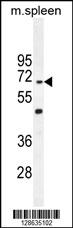 CCDC9 Antibody (N-term) (Cat. #AP10786a) western blot analysis in mouse spleen tissue lysates (35ug/lane).This demonstrates the CCDC9 antibody detected the CCDC9 protein (arrow).