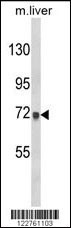 Western blot analysis of AMOTL2 Antibody (Center) (Cat. #AP8860c) in mouse liver tissue lysates (35ug/lane). AMOTL2 (arrow) was detected using the purified Pab.