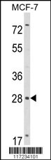 Western blot analysis of RASL11B Antibody (N-term) (Cat. #AP8789a) in MCF-7 cell line lysates (35ug/lane). RASL11B (arrow) was detected using the purified Pab.