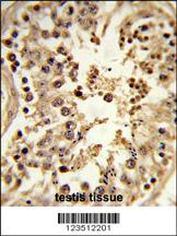 Formalin-fixed and paraffin-embedded human testis tissue reacted with CDC42EP3 Antibody (N-term), which was peroxidase-conjugated to the secondary antibody, followed by DAB staining. This data demonstrates the use of this antibody for immunohistochemistry; clinical relevance has not been evaluated.