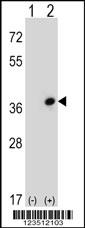 Western blot analysis of CDC42EP3 (arrow) using rabbit polyclonal CDC42EP3 Antibody (N-term) (Cat. #AP8775a). 293 cell lysates (2 ug/lane) either nontransfected (Lane 1) or transiently transfected (Lane 2) with the CDC42EP3 gene.