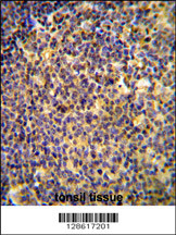 ANR44 Antibody (Center) (Cat. #AP10778c) immunohistochemistry analysis in formalin fixed and paraffin embedded human tonsil tissue followed by peroxidase conjugation of the secondary antibody and DAB staining. This data demonstrates the use of the ANR44 Antibody (Center) for immunohistochemistry. Clinical relevance has not been evaluated.