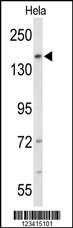 Western blot analysis of FNDC3B Antibody (N-term) (Cat. #AP8766a) in Hela cell line lysates (35ug/lane). FNDC3B (arrow) was detected using the purified Pab.