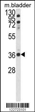 Western blot analysis of CCDC3 Antibody (C-term) (Cat. #AP8744b) in mouse bladder tissue lysates (35ug/lane). CCDC3 (arrow) was detected using the purified Pab.