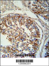 SACA1 antibody (N-term) (Cat. #AP10775a) immunohistochemistry analysis in formalin fixed and paraffin embedded human testis tissue followed by peroxidase conjugation of the secondary antibody and DAB staining. This data demonstrates the use of the SACA1 antibody (N-term) for immunohistochemistry. Clinical relevance has not been evaluated.