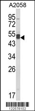 Western blot analysis of AGPAT3 Antibody (Center) (Cat. #AP8686c) in A2058 cell line lysates (35ug/lane). AGPAT3 (arrow) was detected using the purified Pab.