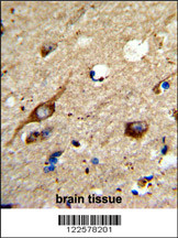 Formalin-fixed and paraffin-embedded human brain tissue reacted with AGPAT3 Antibody (Center), which was peroxidase-conjugated to the secondary antibody, followed by DAB staining. This data demonstrates the use of this antibody for immunohistochemistry; clinical relevance has not been evaluated.