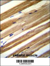 CU070 antibody (C-term) (Cat. #AP10769b)immunohistochemistry analysis in formalin fixed and paraffin embedded human skeletal muscle followed by peroxidase conjugation of the secondary antibody and DAB staining.This data demonstrates the use of CU070 antibody (C-term) for immunohistochemistry. Clinical relevance has not been evaluated.