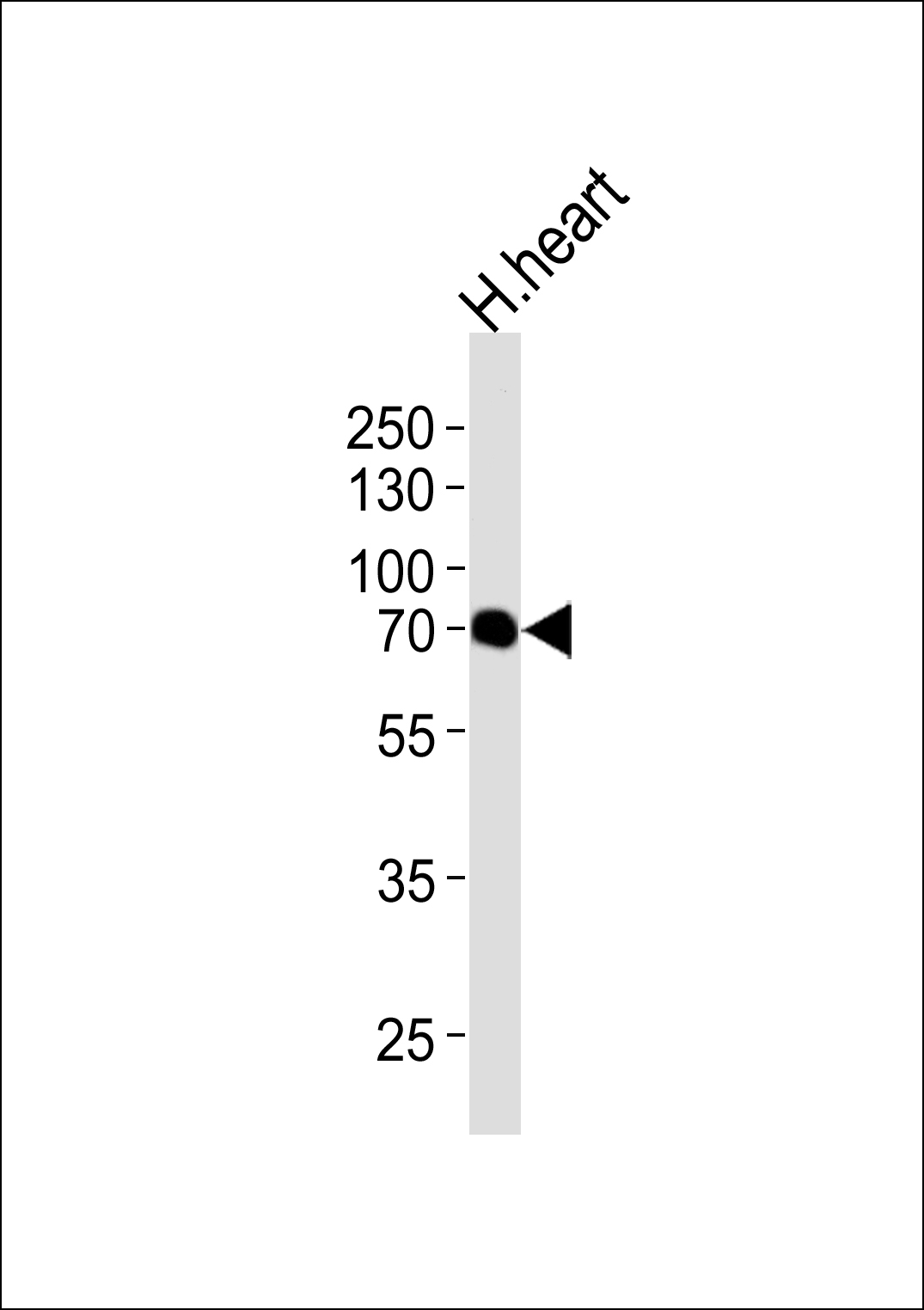Western blot analysis of lysate from human heart tissue lysate, using CLPX Antibody (C-term)(Cat. #AP10767b). AP10767b was diluted at 1:1000 at each lane. A goat anti-rabbit IgG H&L(HRP) at 1:5000 dilution was used as the secondary antibody. Lysate at 35ug per lane. 