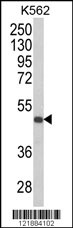 Western blot analysis of KIR3DS1 Antibody (C-term) (Cat. #AP8673b) in K562 cell line lysates (35ug/lane). KIR3DS1 (arrow) was detected using the purified Pab.