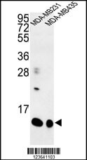 Western blot analysis of SPRR1B Antibody (C-term) (Cat. #AP9052b) in MDA-MB231, MDA-MB435 cell line lysates (35ug/lane). SPRR1B (arrow) was detected using the purified Pab.
