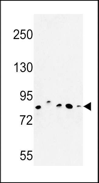 Western blot analysis of CHPF Antibody (Center) (Cat. #AP9046c) in MDA-MB435, MCF-7, HepG2, A375 cell line and mouse testis tissue lysates (35ug/lane). CHPF (arrow) was detected using the purified Pab.