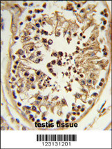 Formalin-fixed and paraffin-embedded human testis tissue reacted with CHPF Antibody (Center), which was peroxidase-conjugated to the secondary antibody, followed by DAB staining. This data demonstrates the use of this antibody for immunohistochemistry; clinical relevance has not been evaluated.