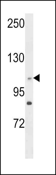 Western blot analysis of C14orf145 Antibody (Center) (Cat. #AP8980c) in HL-60 cell line lysates (35ug/lane). C14orf145 (arrow) was detected using the purified Pab.