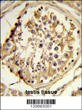 Formalin-fixed and paraffin-embedded human testis reacted with C14orf145 Antibody (Center), which was peroxidase-conjugated to the secondary antibody, followed by DAB staining. This data demonstrates the use of this antibody for immunohistochemistry; clinical relevance has not been evaluated.