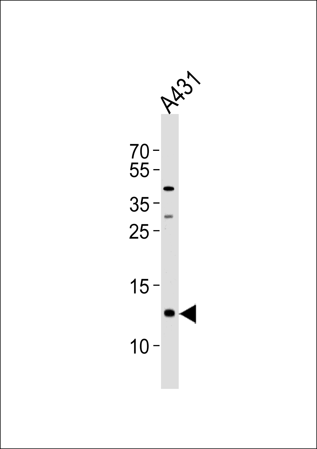 Western blot analysis of lysate from A431 cell line, using SPRR2A Antibody (C-term)(Cat. #AP10758b). AP10758b was diluted at 1:1000 at each lane. A goat anti-rabbit IgG H&L(HRP) at 1:5000 dilution was used as the secondary antibody. Lysate at 35ug per lane.