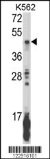Western blot analysis of KIR2DL5B Antibody (Center) (Cat. #AP8909c) in K562 cell line lysates (35ug/lane). KIR2DL5B (arrow) was detected using the purified Pab.