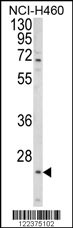 Western blot analysis of ALG14 Antibody (Center) (Cat. #AP8903c) in NCI-H460 cell line lysates (35ug/lane). ALG14 (arrow) was detected using the purified Pab.