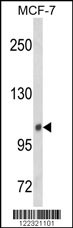 Western blot analysis of INPP4B Antibody (Center) (Cat. #AP8902c) in MCF-7 cell line lysates (35ug/lane). INPP4B (arrow) was detected using the purified Pab.