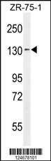 TLL1 Antibody (C-term) (Cat. #AP10755b) western blot analysis in ZR-75-1 cell line lysates (35ug/lane).This demonstrates the TLL1 antibody detected the TLL1 protein (arrow).