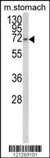 Western blot analysis of TCERG1L Antibody (Center) (Cat. #AP8880c) in mouse stomach tissue lysates (35ug/lane). TCERG1L (arrow) was detected using the purified Pab.