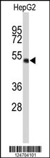 Western blot analysis of WDR37 Antibody (C-term) (Cat. #AP9251b) in HepG2 cell line lysates (35ug/lane). WDR37 (arrow) was detected using the purified Pab.