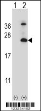 Western blot analysis of TSPAN6 (arrow) using rabbit polyclonal TSPAN6 Antibody (C-term) (Cat. #AP9224b). 293 cell lysates (2 ug/lane) either nontransfected (Lane 1) or transiently transfected (Lane 2) with the TSPAN6 gene.