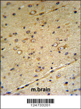 S39A3 Antibody (Center) (Cat. #AP9206c) IHC analysis in formalin fixed and paraffin embedded mouse brain tissue followed by peroxidase conjugation of the secondary antibody and DAB staining. This data demonstrates the use of the S39A3 Antibody (Center) for immunohistochemistry. Clinical relevance has not been evaluated.