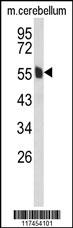 Western blot analysis of MPP6 Antibody (Center) (Cat. #AP9201c) in mouse cerebellum tissue lysates (35ug/lane). MPP6 (arrow) was detected using the purified Pab.