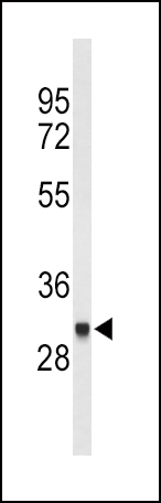 Western blot analysis of FCGR1B Antibody (C-term) (Cat. #AP9197b) in CEM cell line lysates (35ug/lane). FCGR1B (arrow) was detected using the purified Pab.