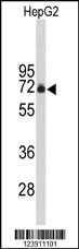 Western blot analysis of FBXO3 Antibody (C-term) (Cat. #AP9195b) in HepG2 cell line lysates (35ug/lane). FBXO3 (arrow) was detected using the purified Pab.
