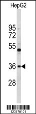 Western blot analysis of ELOVL2 Antibody (N-term) (Cat. #AP9191a) in HepG2 cell line lysates (35ug/lane). ELOVL2 (arrow) was detected using the purified Pab.