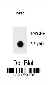 Dot blot analysis of Phospho-mouse JUN-T289 Antibody Phospho-specific Pab (Cat. #AP3783b) on nitrocellulose membrane. 50ng of Phospho-peptide or Non Phospho-peptide per dot were adsorbed. Antibody working concentrations are 0.6ug per ml.