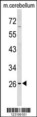 Western blot analysis of PXMP4 Antibody (Center) (Cat. #AP9180c) in mouse cerebellum tissue lysates (35ug/lane). PXMP4 (arrow) was detected using the purified Pab.