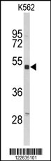 Western blot analysis of KIR3DL3 Antibody (Center) (Cat. #AP9170c) in K562 cell line lysates (35ug/lane). KIR3DL3 (arrow) was detected using the purified Pab.